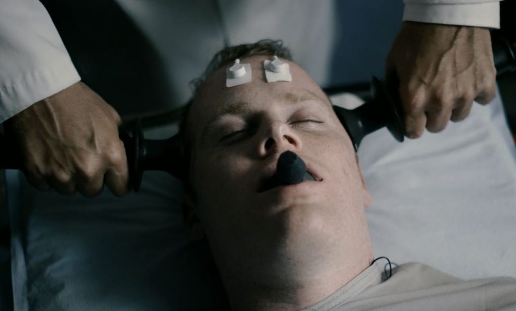 Electroconvulsive Therapy